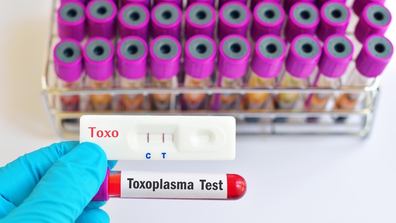 Cek toksoplasma sebelum hamil/ Foto: Thinkstock Cek toksoplasma sebelum hamil/ Foto: Thinkstock