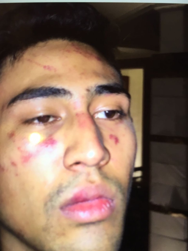 Kronologi Anak Jeremy Thomas yang Disekap dan Dikeroyok Oknum Polisi Kronologi Anak Jeremy Thomas yang Disekap dan Dikeroyok Oknum Polisi