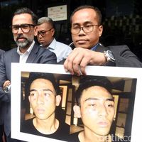 Dikeroyok, iPhone dan Dompet Anak Jeremy Thomas Juga Dirampas