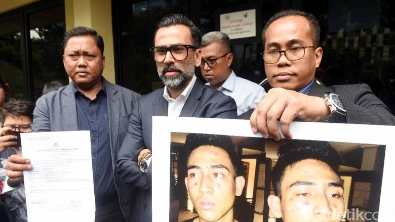 Jeremy Thomas Tak Terima Anaknya Diperlakukan Seperti Binatang Jeremy Thomas Tak Terima Anaknya Diperlakukan Seperti Binatang