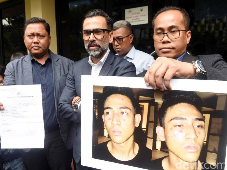 Benarkah Polisi Tangkap Anak Jeremy Thomas karena Mau Transaksi Narkoba? Benarkah Polisi Tangkap Anak Jeremy Thomas karena Mau Transaksi Narkoba?