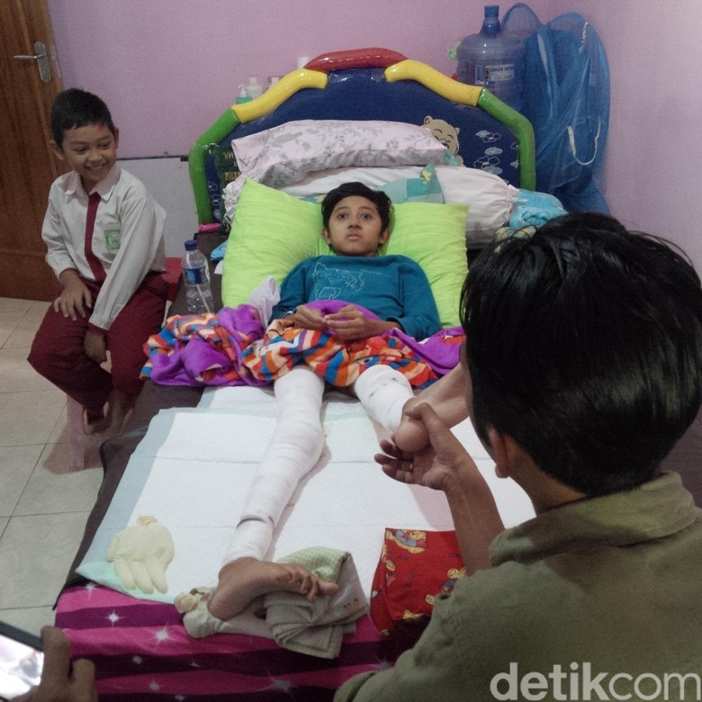 Derita Bocah Helmi yang Alami Luka Bakar saat Ikuti Kegiatan Pramuka Derita Bocah Helmi yang Alami Luka Bakar saat Ikuti Kegiatan Pramuka