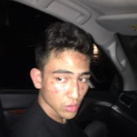 Babak Belur Disiksa Oknum Polisi, Anak Jeremy Thomas Luka Parah