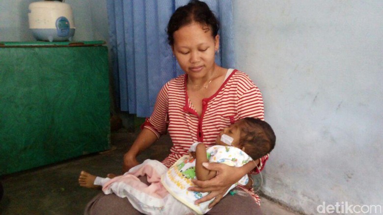 Bayi dari Keluarga Tak Mampu di Magelang ini Menderita Kelainan Hati Bayi dari Keluarga Tak Mampu di Magelang ini Menderita Kelainan Hati