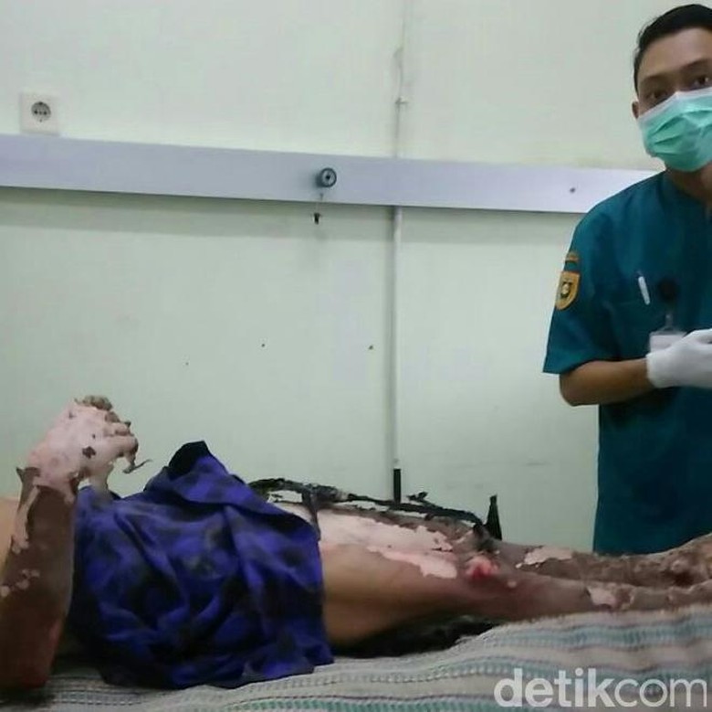 Tersengat Listrik, Tukang Bangunan di Purworejo Luka Bakar Parah Tersengat Listrik, Tukang Bangunan di Purworejo Luka Bakar Parah