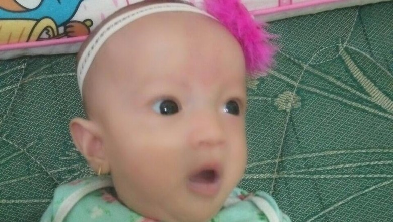Belajar dari Kasus Debora, ICW Desak Tim Pengawas Jamkes Dibentuk Belajar dari Kasus Debora, ICW Desak Tim Pengawas Jamkes Dibentuk