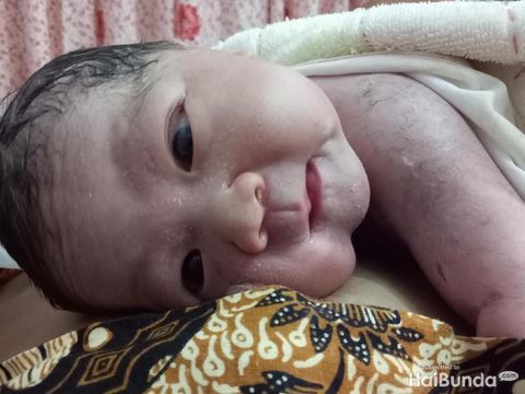 Ilustrasi kulit bayi baru lahir/