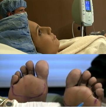 Demi Nyaman Pakai High Heels, 3 Wanita Ini Operasi Plastik Kaki Demi Nyaman Pakai High Heels, 3 Wanita Ini Operasi Plastik Kaki