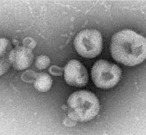 Awas! Ada Virus Baru yang Mematikan Awas! Ada Virus Baru yang Mematikan