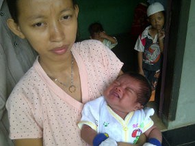 Dokter: Bayi Nangis Darah Kemungkinan Pecah Pembuluh Darah Dokter: Bayi Nangis Darah Kemungkinan Pecah Pembuluh Darah