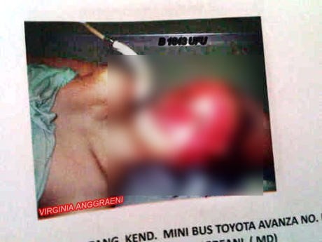Foto Autopsi Istri Saipul Jamil Beredar di Internet? Foto Autopsi Istri Saipul Jamil Beredar di Internet?