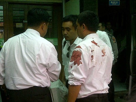 Satpam Pegadaian di Bandung Terluka Ditembak Perampok Satpam Pegadaian di Bandung Terluka Ditembak Perampok