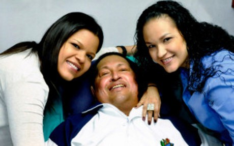 Berjuang Untuk Hidup, Hugo Chavez Jalani Kemoterapi Berjuang Untuk Hidup, Hugo Chavez Jalani Kemoterapi