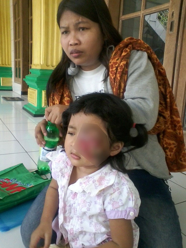 Tolong! Balita di Depok Menderita Kanker Mata dan Butuh Biaya Operasi Tolong! Balita di Depok Menderita Kanker Mata dan Butuh Biaya Operasi